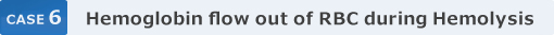 CASE 6FHemoglobin flow out of RBC during Hemolysis
